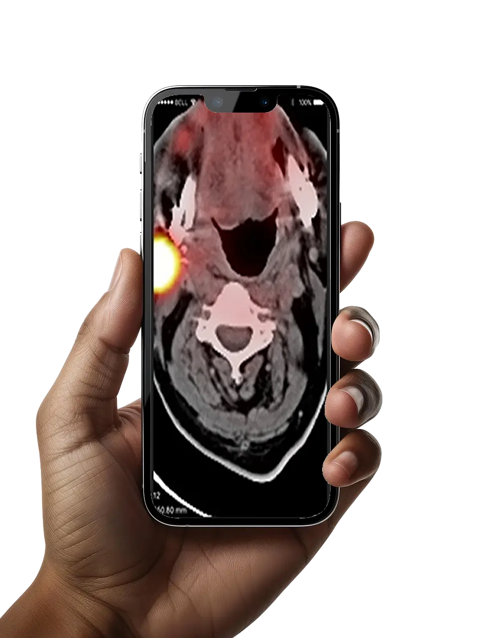 Apple Watch Thumbnail